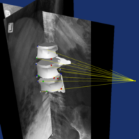 Spinal Image Analysis
